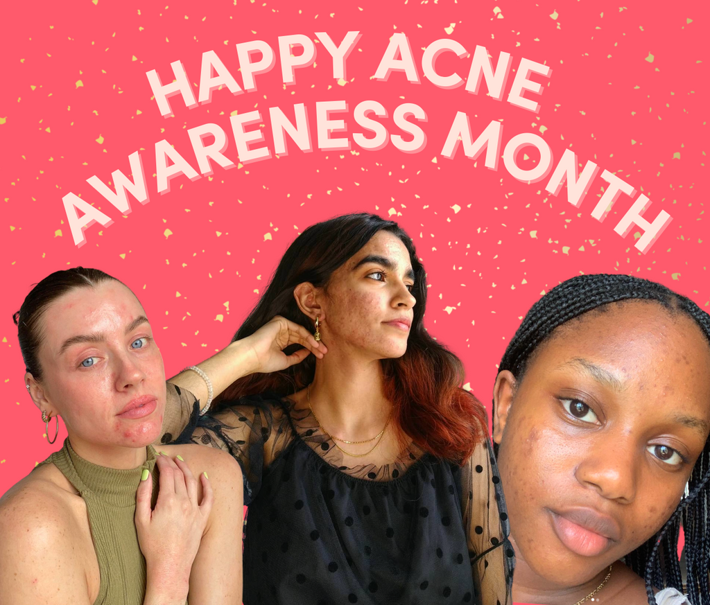 Happy Acne Awareness Month!!
